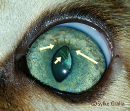 persistierende Pupillarmembran